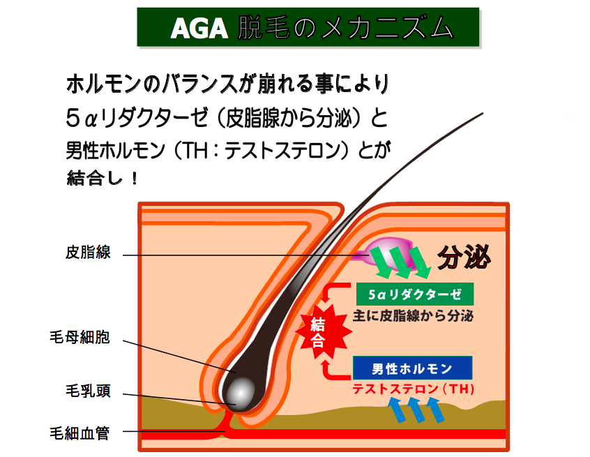 「AGA メカニズム」の画像検索結果